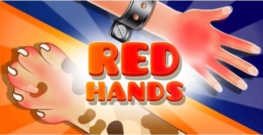 Slap Kings- Red Hand Slap Game by Creative Art Studio